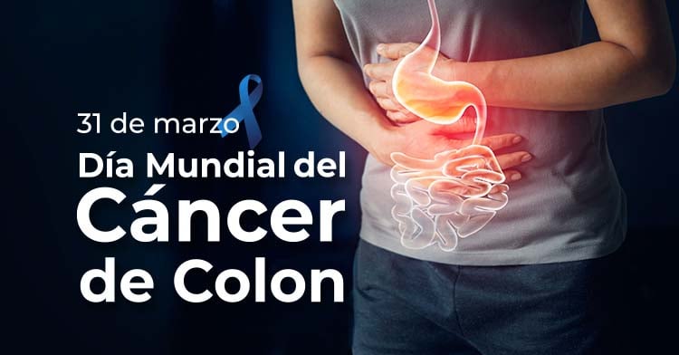 Cáncer de colon: el más diagnosticado en Galicia, pero con un 90% de supervivencia si se detecta a tiempo